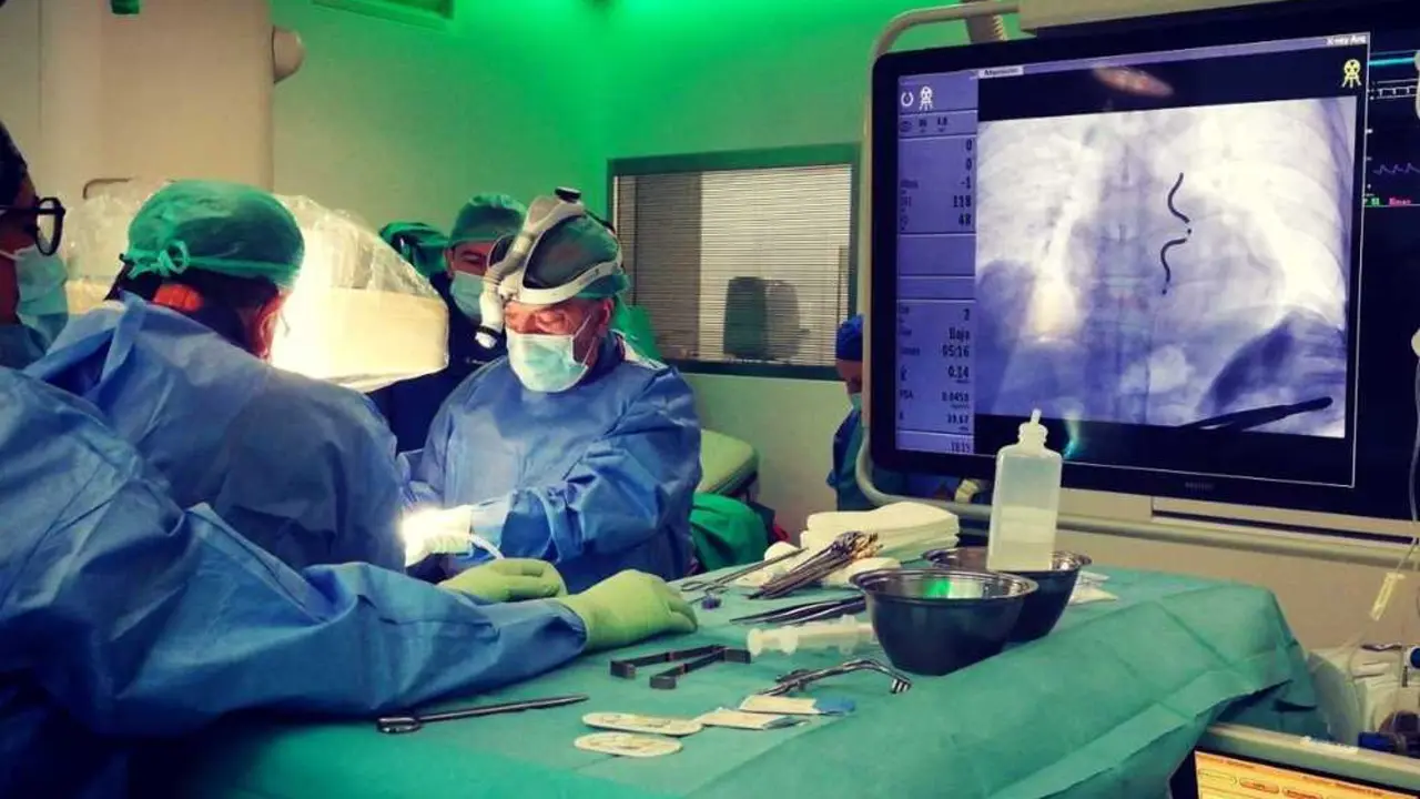 Cirug&iacute;a realizada por el doctor Casares con DAI extravascular | Quir&oacute;nsalud